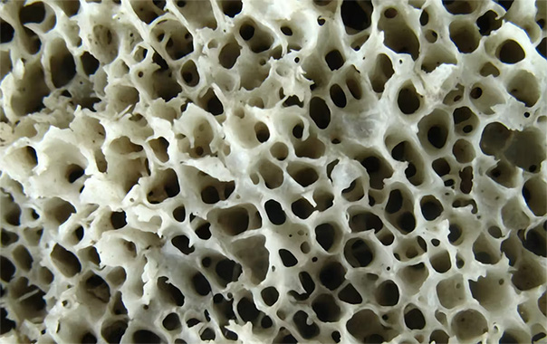 A macro photograph of bone structure.